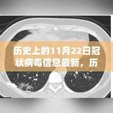历史上的11月22日,冠状病毒全球演变与最新影响