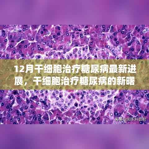 12月干细胞治疗糖尿病最新进展解析,新曙光照亮治疗前景