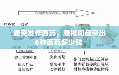 腰突发作西药,腰椎间盘突出6种西药多少钱