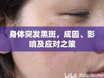 身体突发黑斑,成因、影响及应对之策